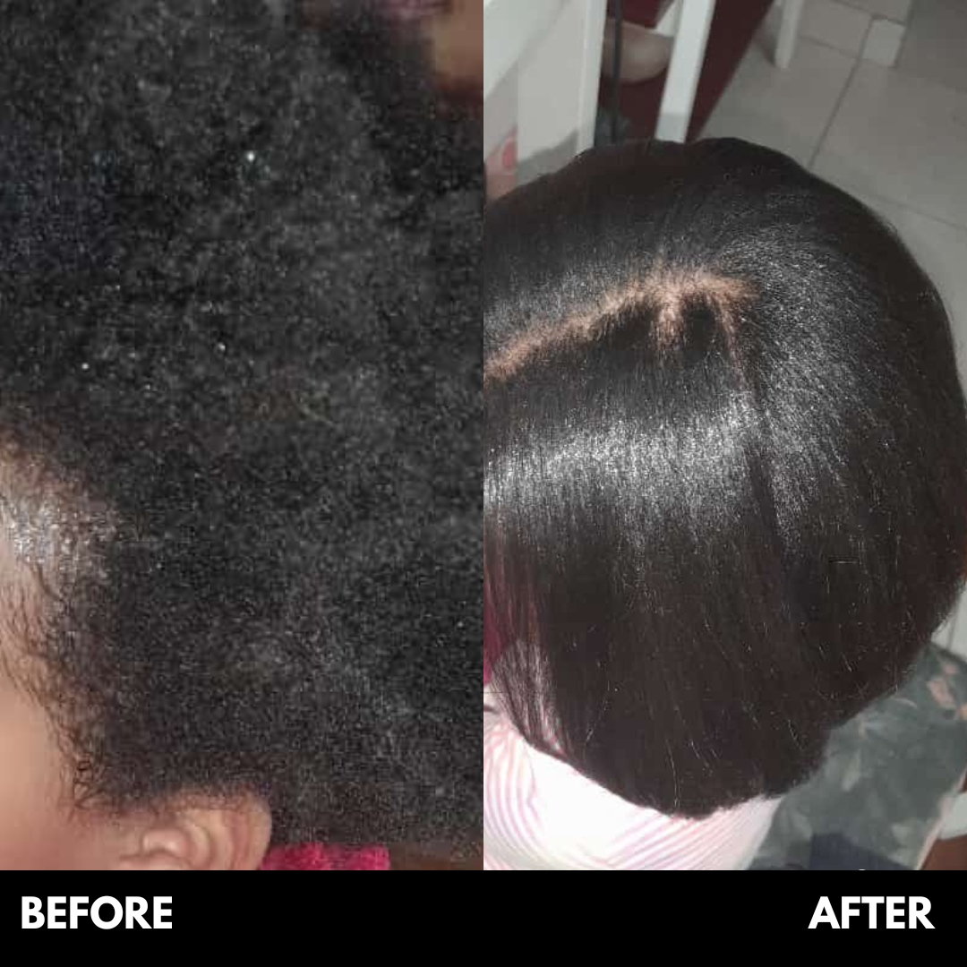 Medihair Straight 200g White